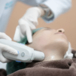 patient receiving hifu treatment