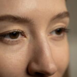 How Eye Bags Form and the Best Methods for Eye Bags Removal