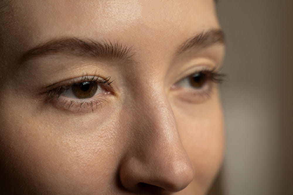 How Eye Bags Form and the Best Methods for Eye Bags Removal