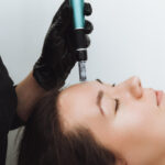 What Is Microneedling and Why It Benefits the Skin