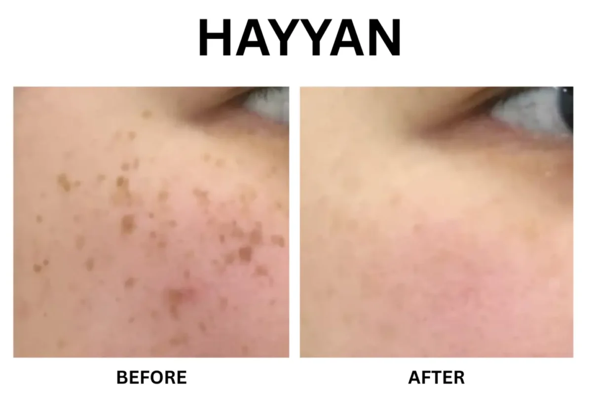 94115775-e6ce-412d-9851-351a4da94356