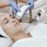 woman getting hifu treatment