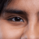 woman with dark eye circles