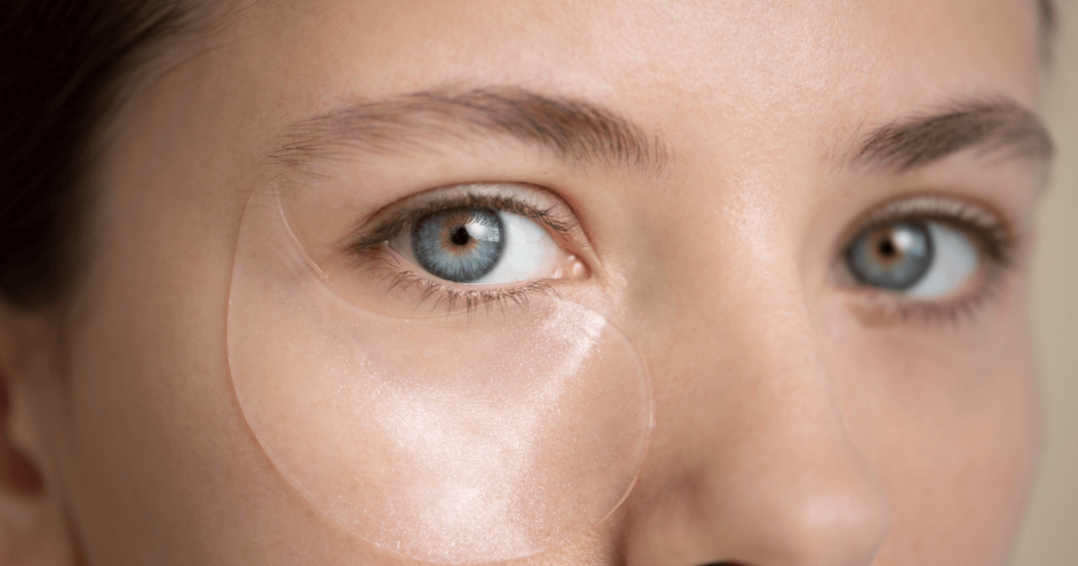 woman with clear patches under her eyes