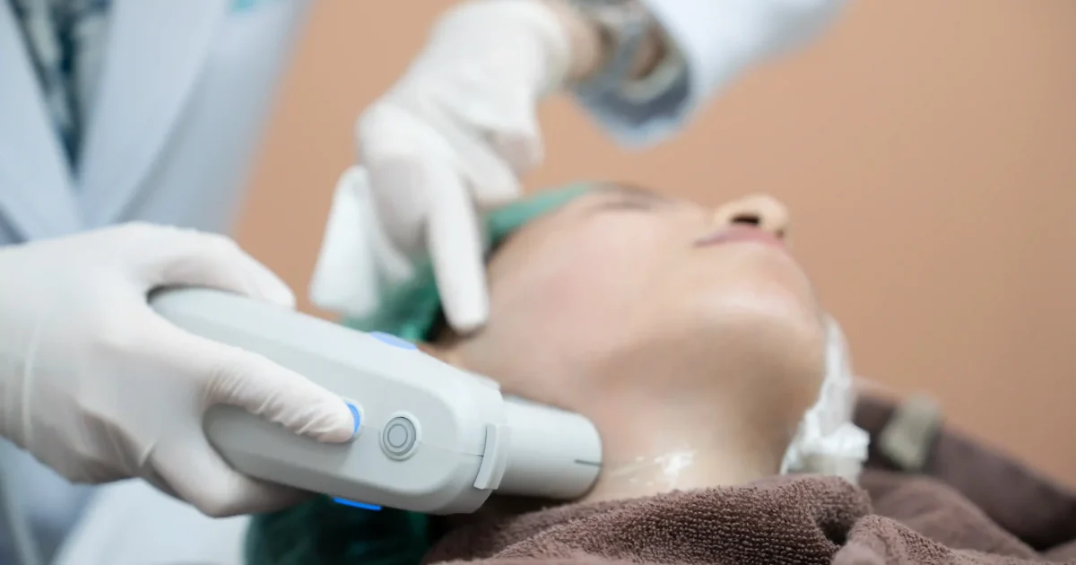 hifu treatment