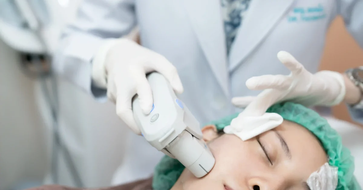 patient undergoing hifu treatment