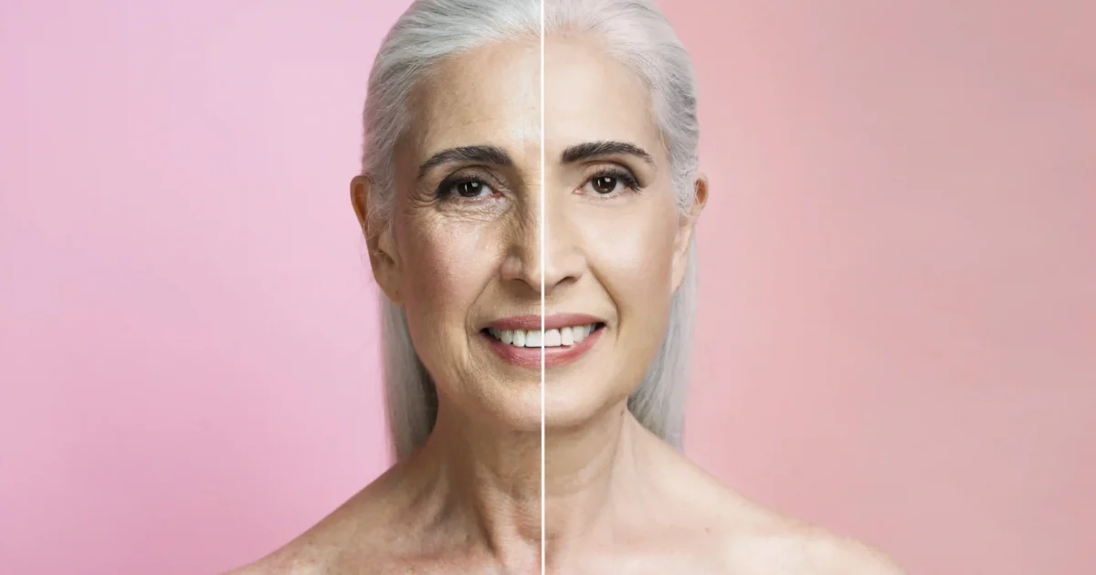 before and after of skin treatment