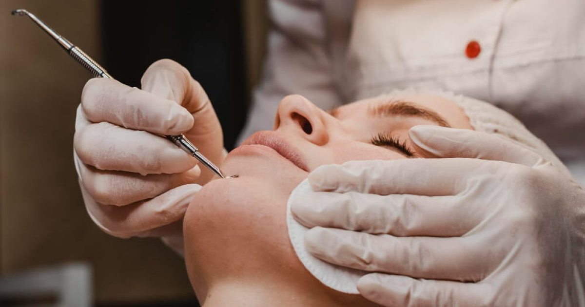 woman undergoing blackhead removal treatment