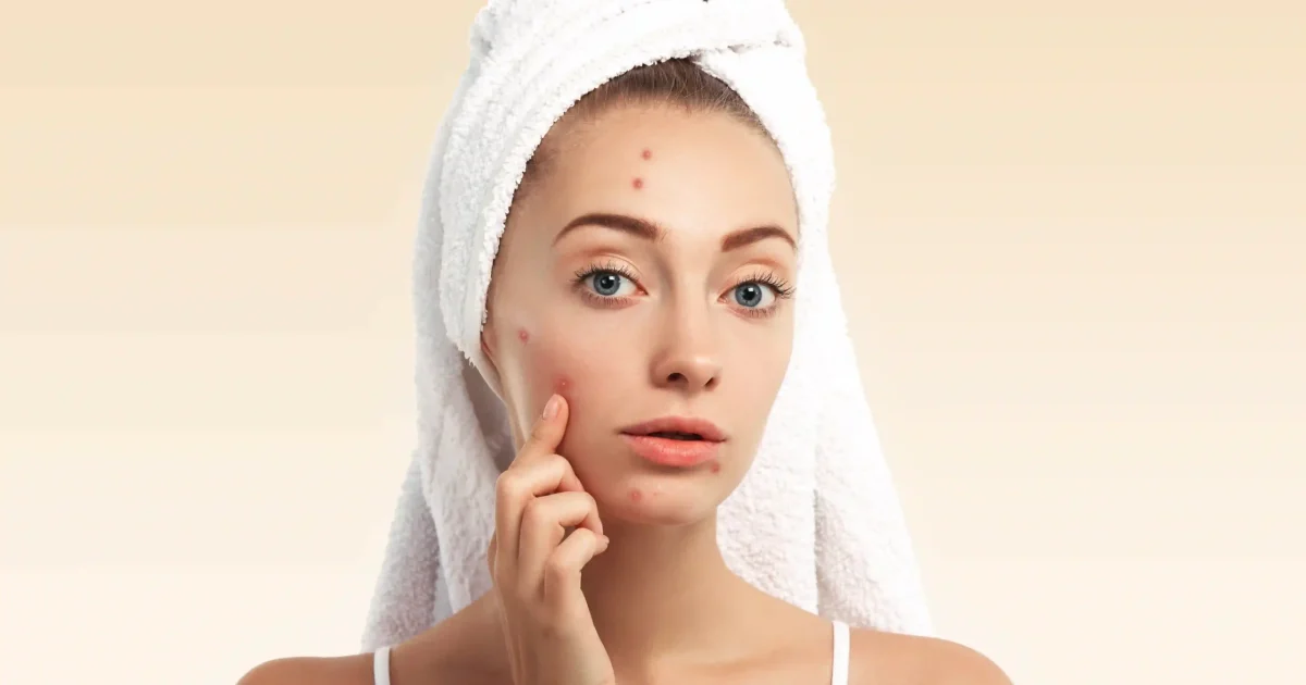 woman with towel on her head checking for pimples