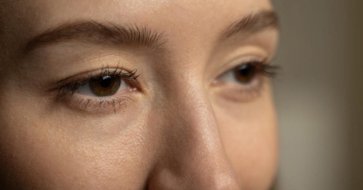 woman with eye bags under her eyes