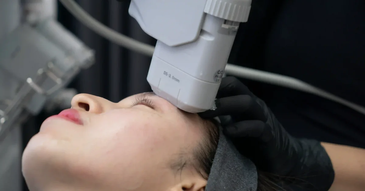 woman undergoing hifu treatment