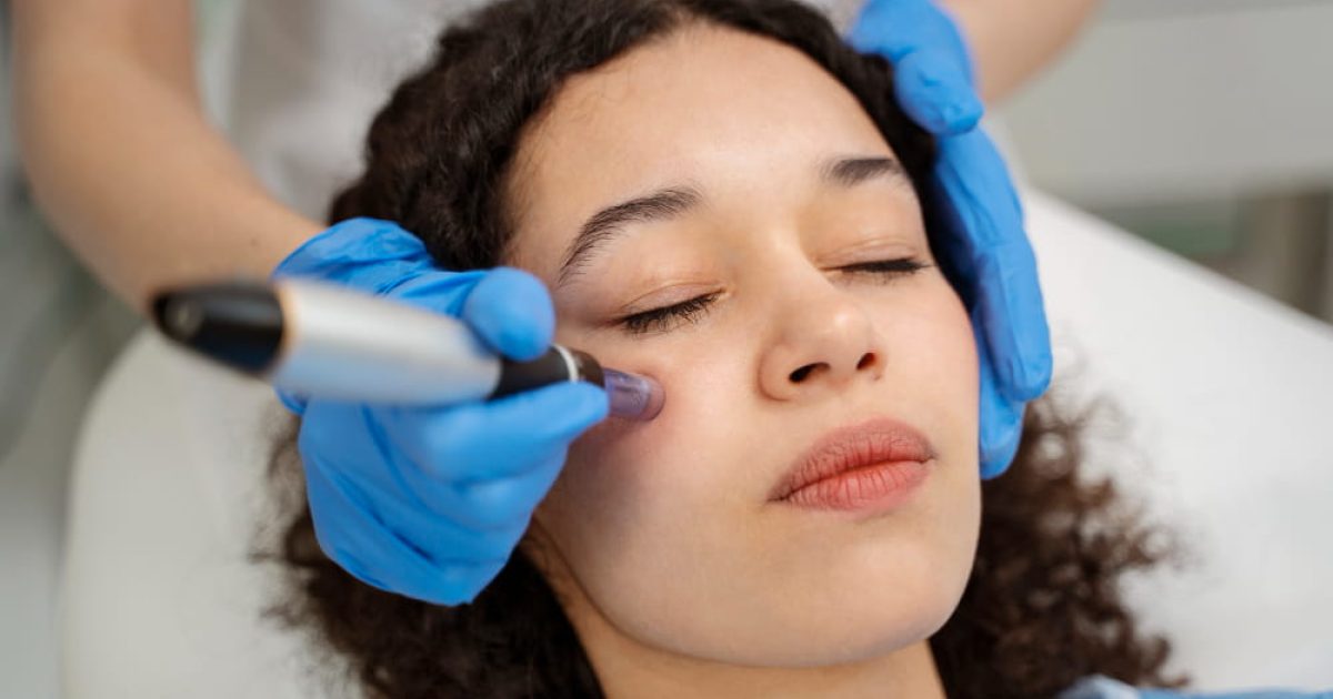 woman undergoing microneedling treatment