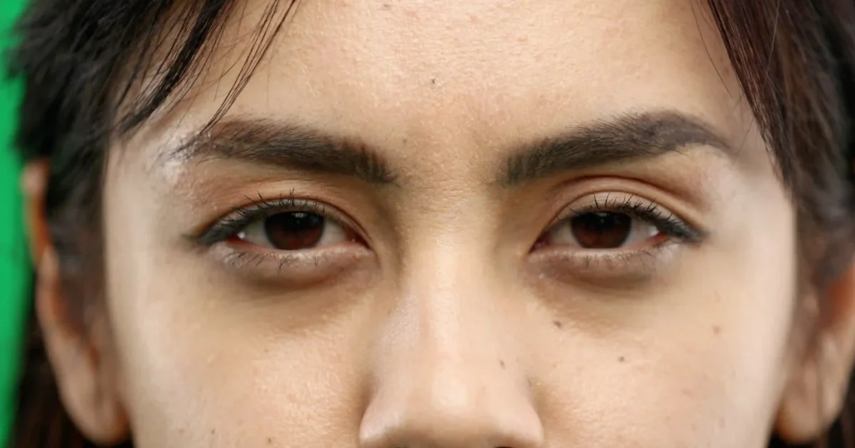close-up photo of a woman with dark eye circles